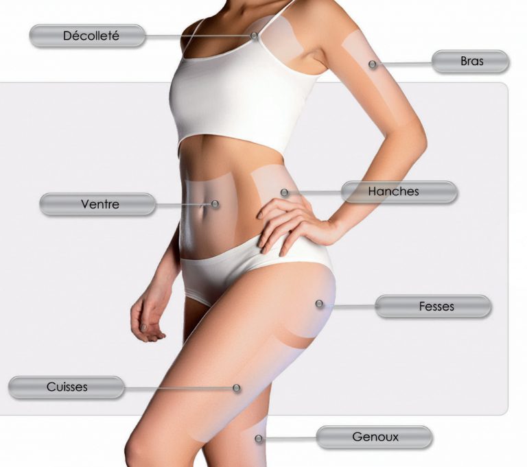 Zones du corps traitées par HIFU corps : décolleté, bras, ventre, hanches, fesses, cuisses, genoux - NUTRI BODY CLINIC